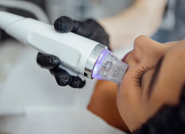 Microneedle RF lifting procedure The Woodlands